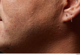 HD Face Skin Gabriel Ros cheek chin ear face skin…
